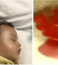 Toy Found In Baby’s Throat After Two Weeks